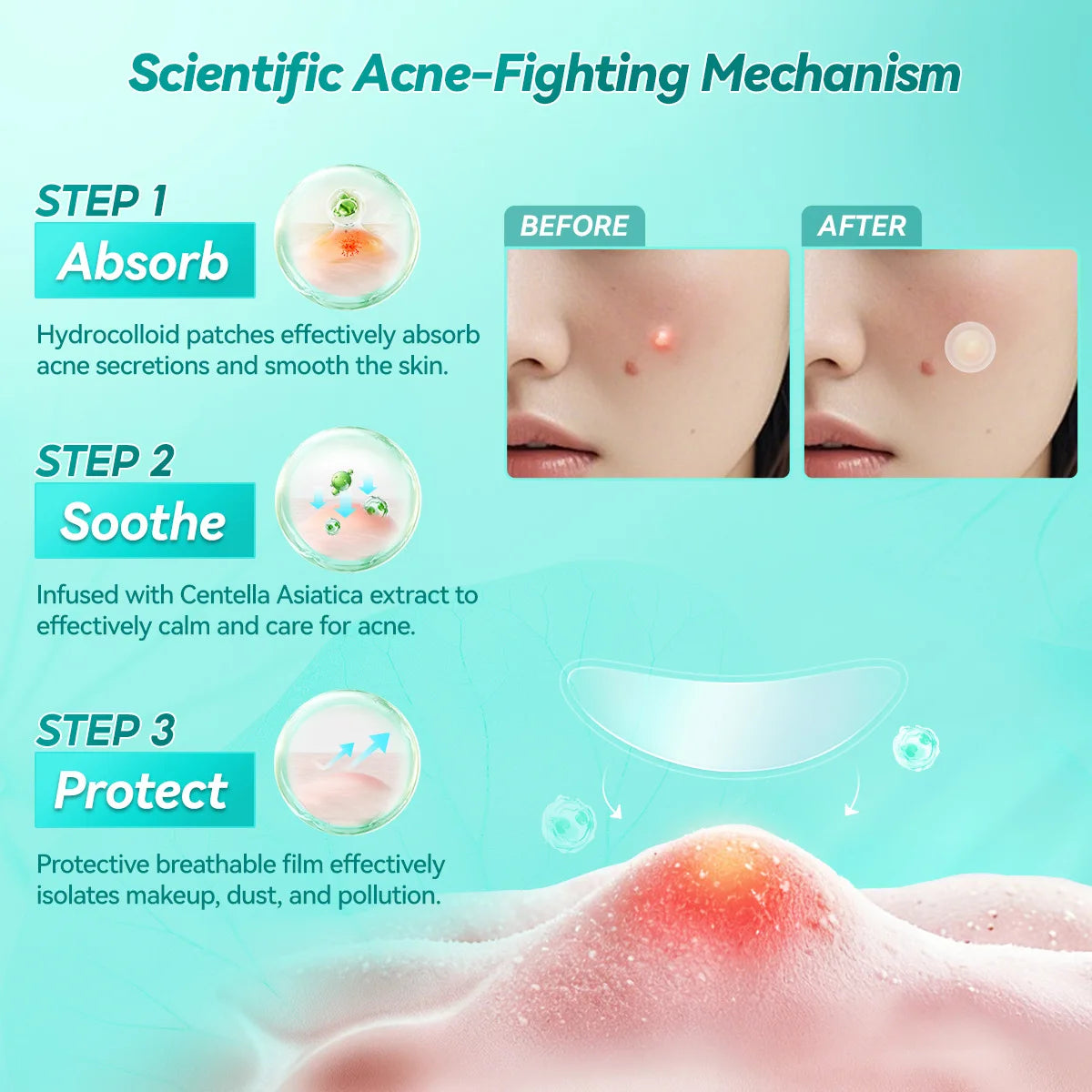 LANBENA Acne Pimple Patch Daily Use and Night Use Invisible Acne Stickers Blemish Treatment Acne Concealer Makeup